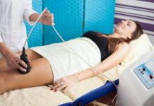 Ablation Therapy Varicose Vein Treatment