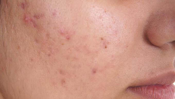 skin diseases causes and treatment